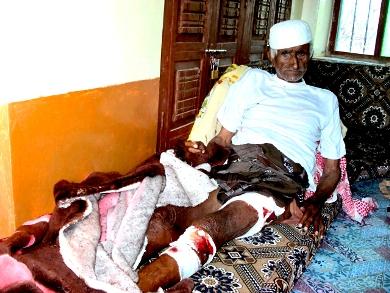 الحاج محمد علوي البارق في المستشفى بيافع متأثرا بجراحه الحاج محمد علوي البارق في المستشفى بيافع متأثرا بجراحه