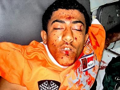 المصاب بشير محمود المصاب بشير محمود