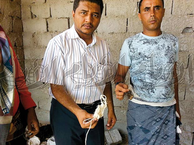 جزء من الحبل
الذي قيدت به
الطفلة شيماء جزء من الحبل
الذي قيدت به
الطفلة شيماء