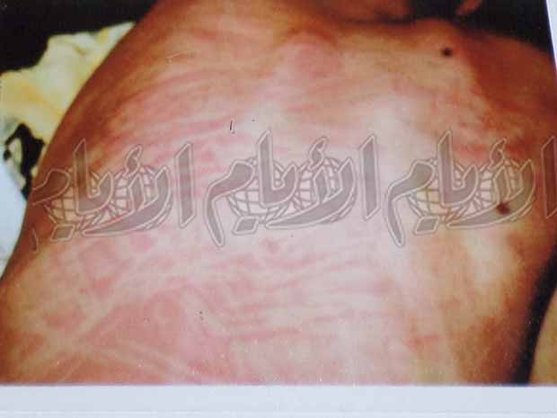 ظهر شكيب سالم باديا عليه آثار التعذيب