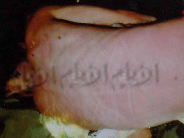آثار التعذيب الذي تعرض له شكيب سالم