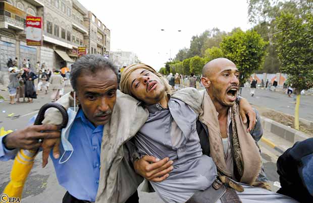 أحد الجرحى الذين سقطوا في تظاهرات صنعاء أمس