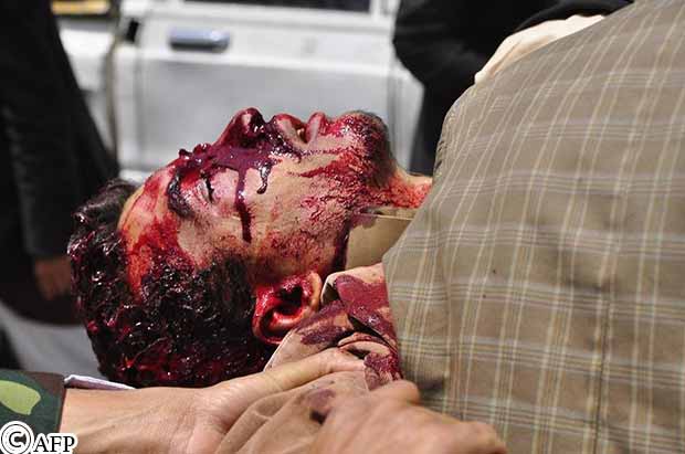 أحد قتلى المصادمات بين المحتجين والأمن بصنعاء أمس أحد قتلى المصادمات بين المحتجين والأمن بصنعاء أمس