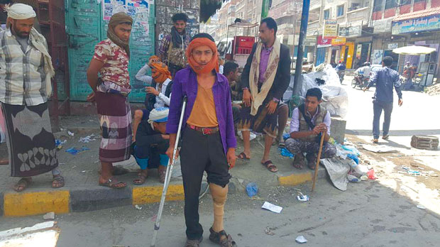 أحد الجرحى المحتجين لاسقاط اسمائهم