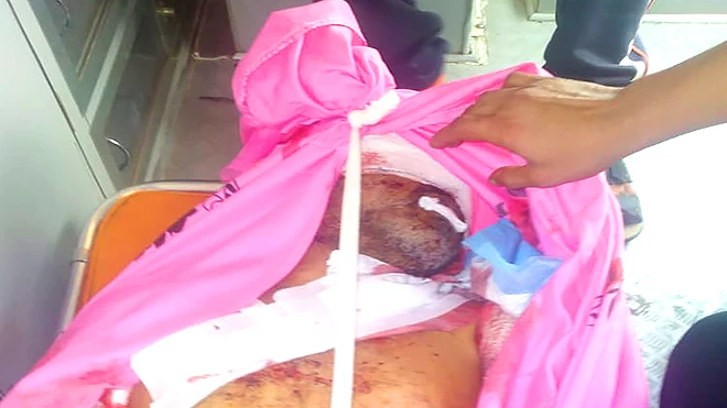 لحج.. شاب يقتل والده بإلقاء قنبلة عليه في المنزل