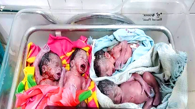 ​حالة نادرة.. امرأة ثلاثينية بشبوة تضع 4 توائم