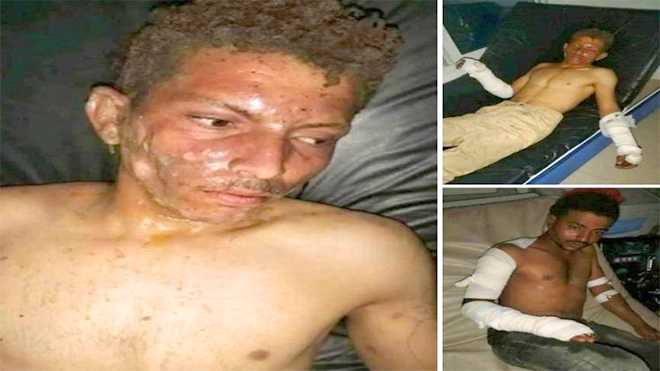 عامل يحرق زملائه بغرفة مغلقة ويفر هاربًا