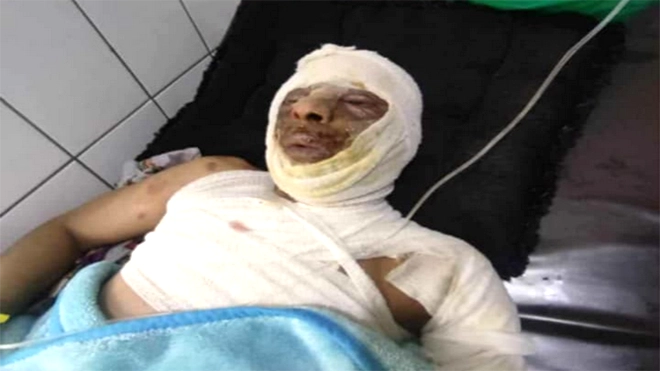 خلاف عائلي يؤدي لحادثة مأساوية في تعز