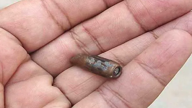 إصابة بالغة لأمراة في لحج جراء رصاصة راجعة