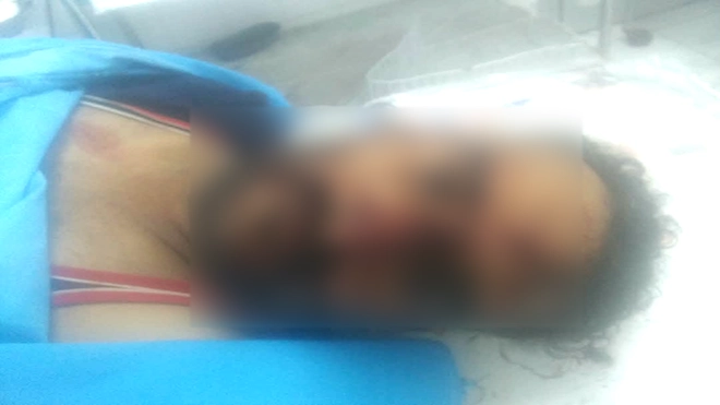 ​وفاة سائق دراجة بحادث تصادم بالعند